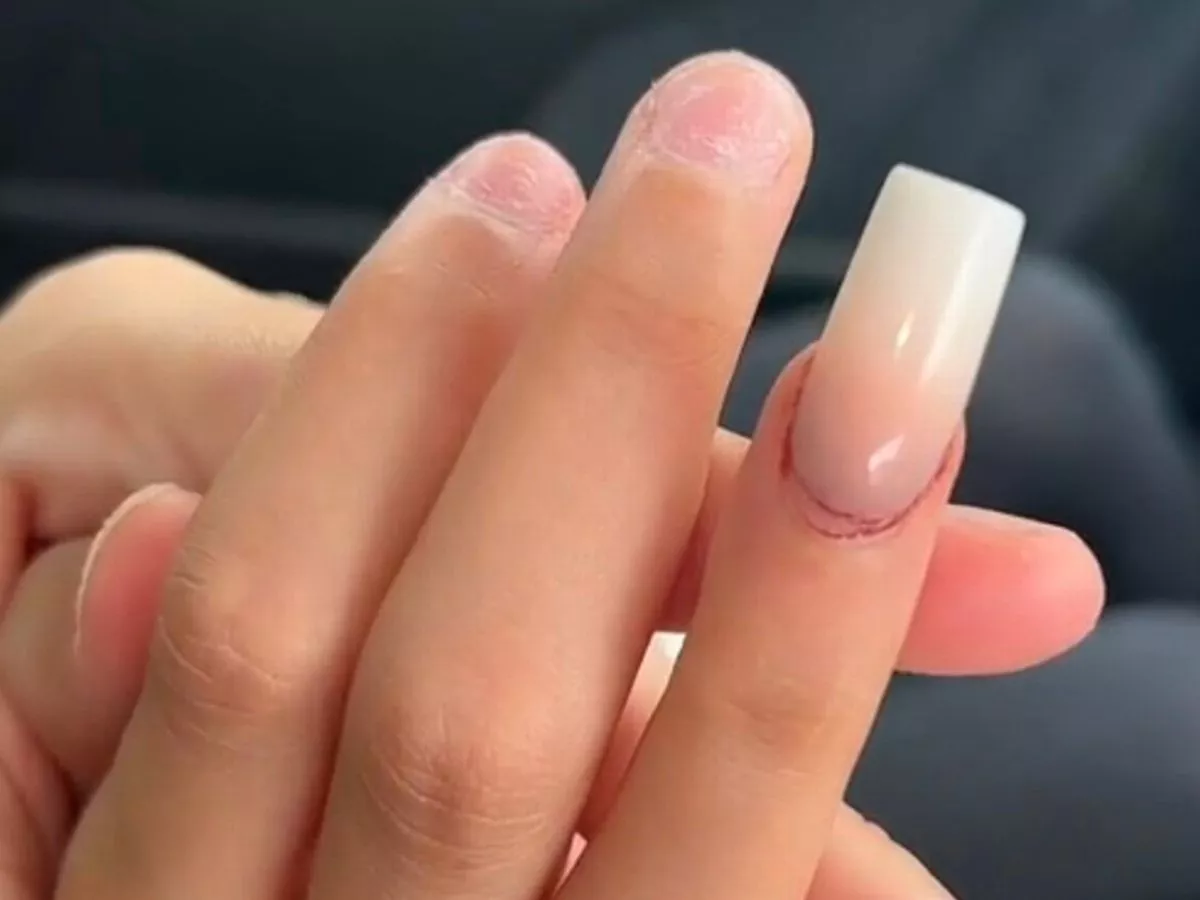 Can You Be Allergic to Acrylic Nails?